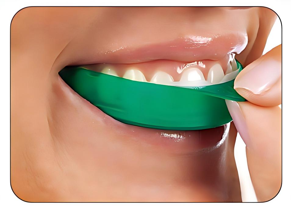 Teeth Whitening Opalescence Go - Tiras Blanqueadoras de Dientes Ultradent Opalescence
