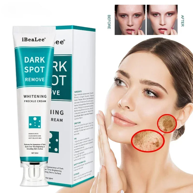 Charcoal Whitening Paste - Crema blanqueadora para pecas, elimina las
