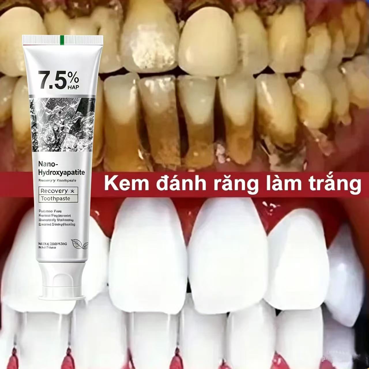 Teeth Whitening That Works - Pasta Dental Blanqueadora Probiótica con 7.5%