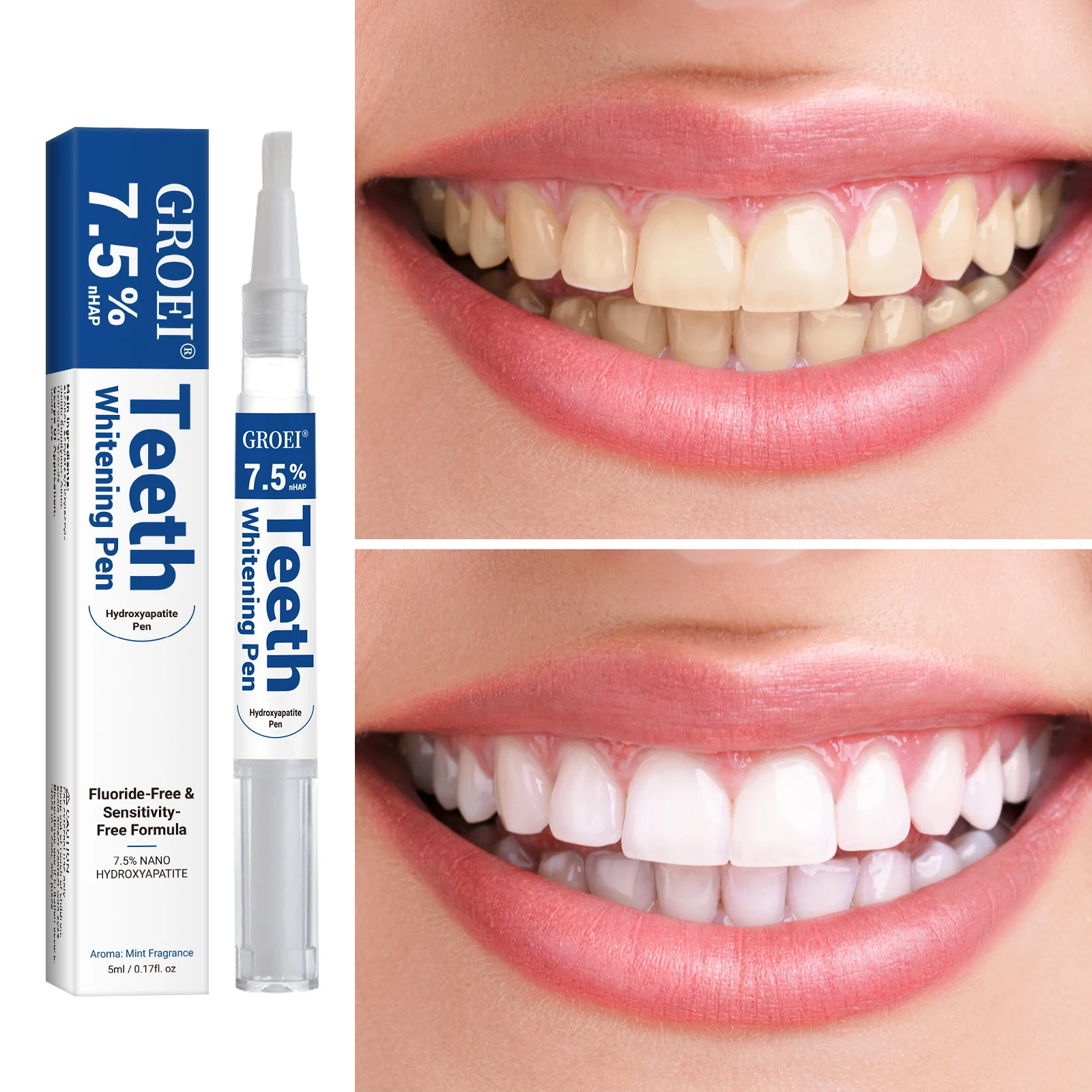 Pluma blanqueadora de dientes  - Teeth Whitening App reseña y precio