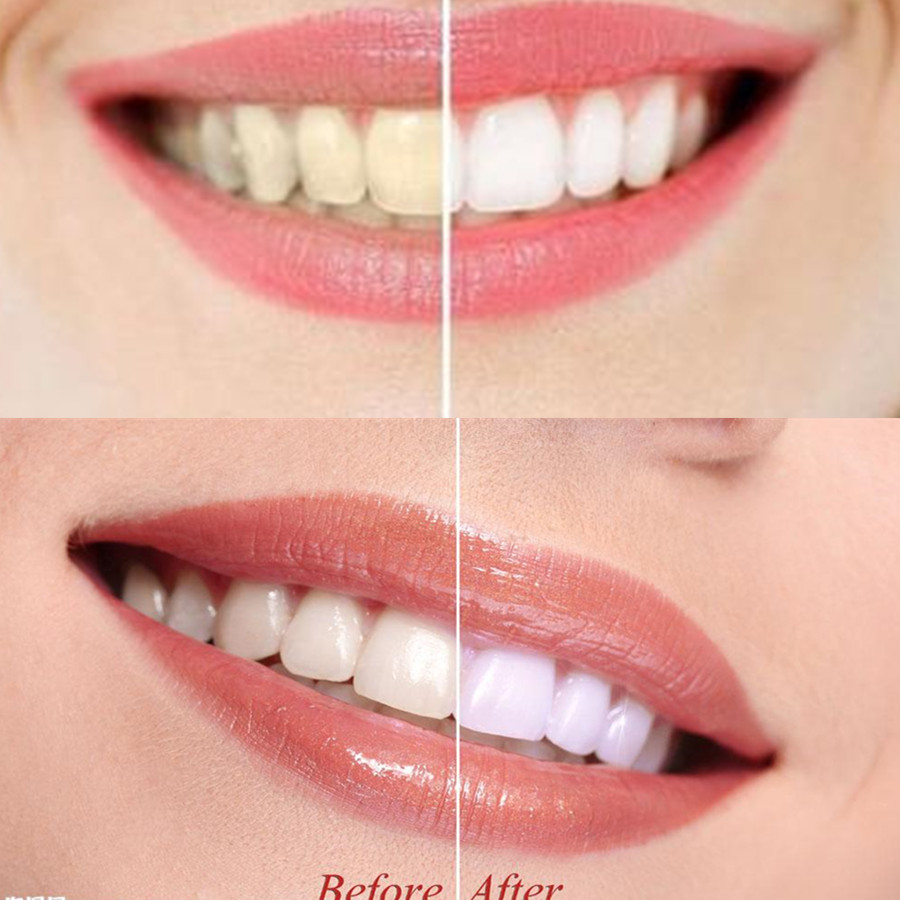 Dientes de carbón de bambú par - Teeth Whitening Flash reseña y precio