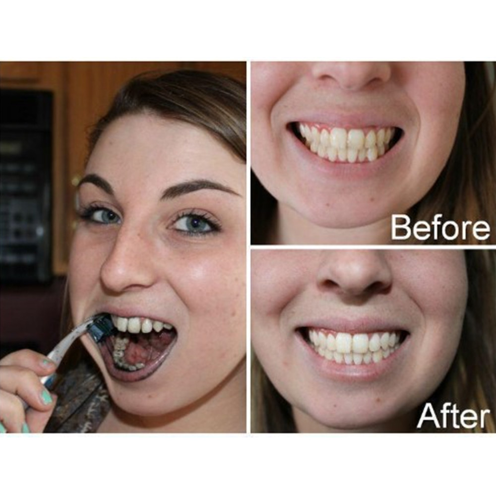 Dientes de carbón de bambú par - Teeth Whitening Flash reseña y precio