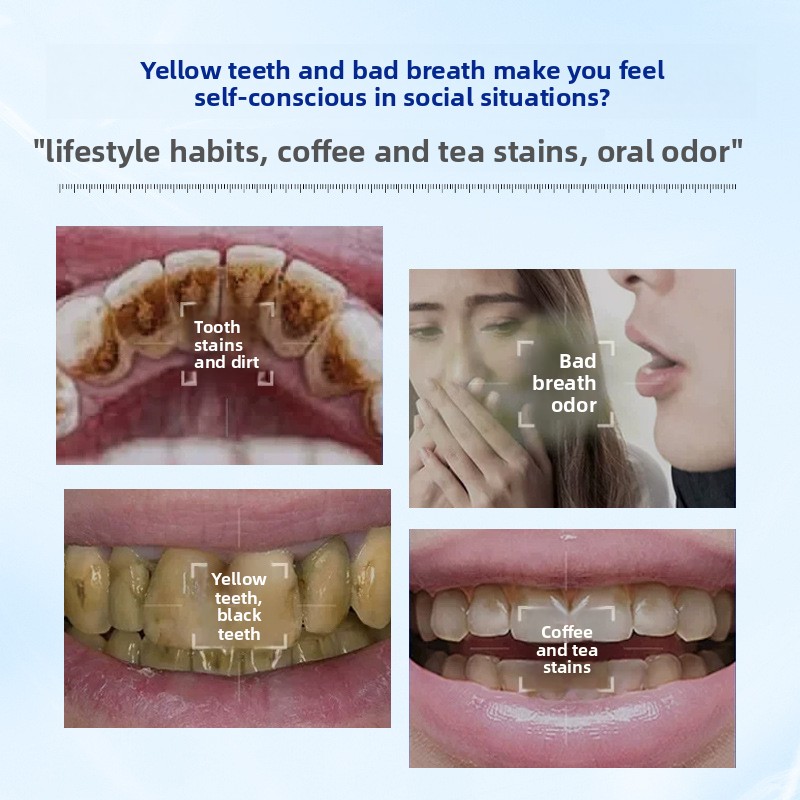 Polvo Dental Enzimático Blanqu - Teeth Whitening Enzymes reseña y precio