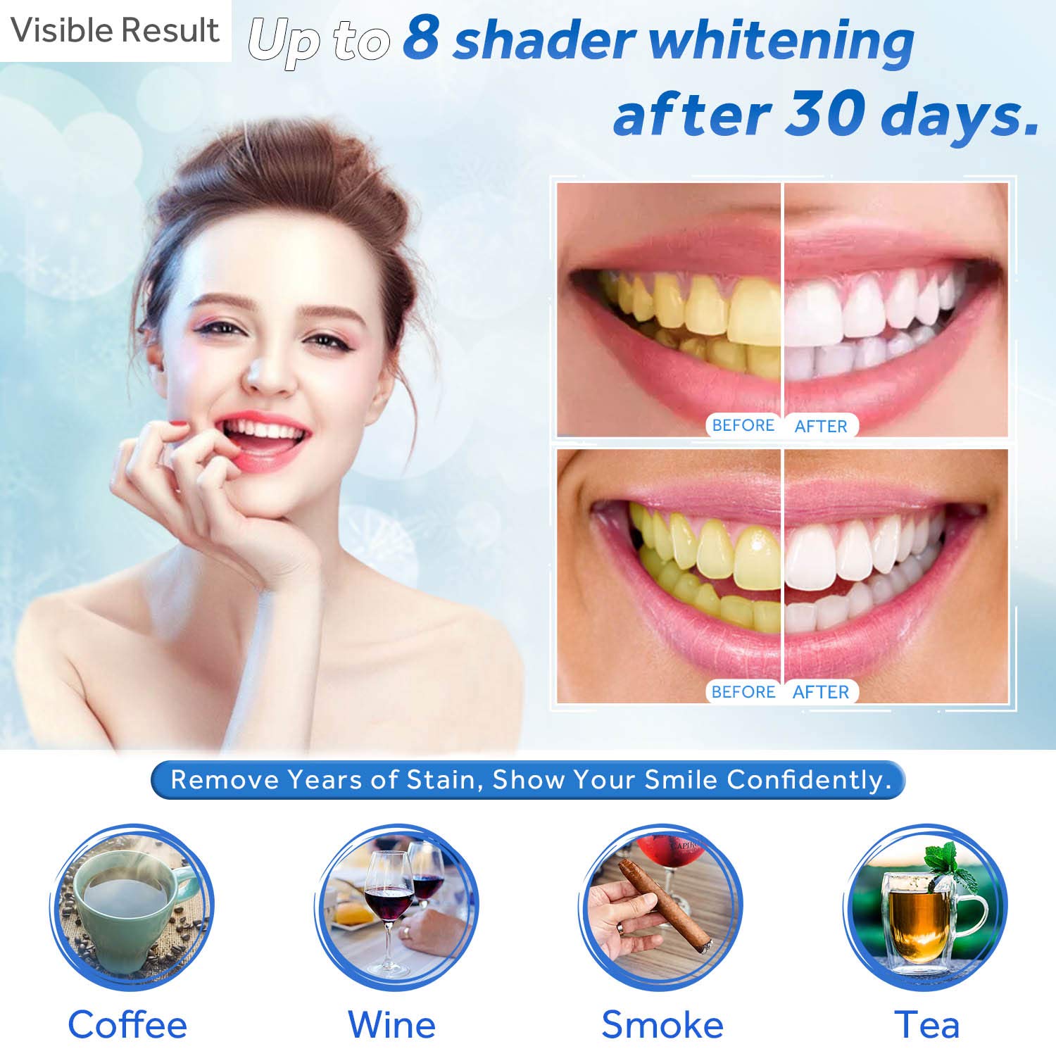 Jeringa de repuesto de Gel par - Teeth Whitening Gels reseña y precio