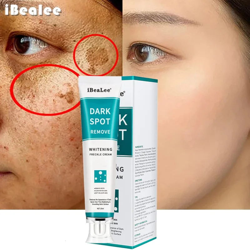 Crema blanqueadora para pecas, - Charcoal Whitening Paste reseña y precio
