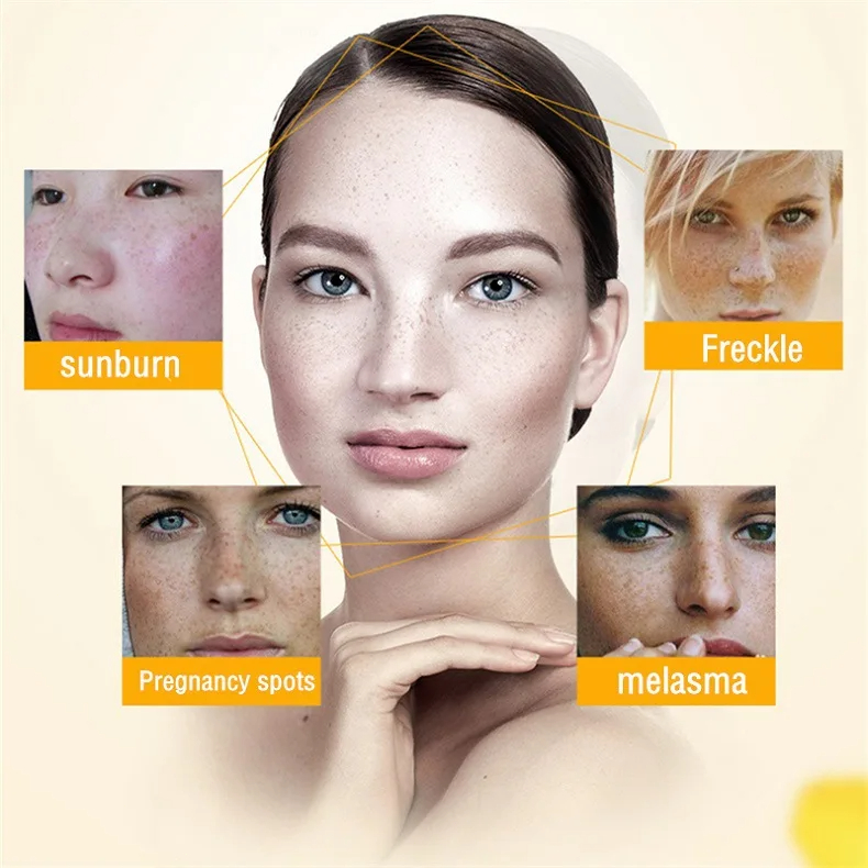 Crema blanqueadora para pecas, - Charcoal Whitening Paste reseña y precio