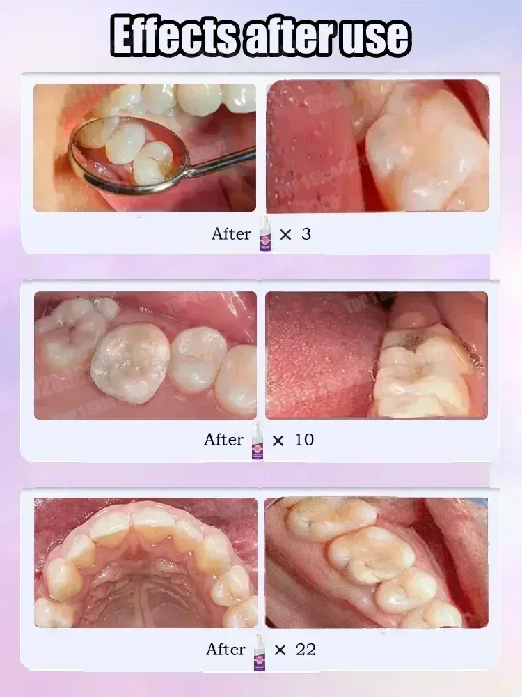 Ventas calientes Más vendido,  - Teeth Whitening That Works reseña y precio