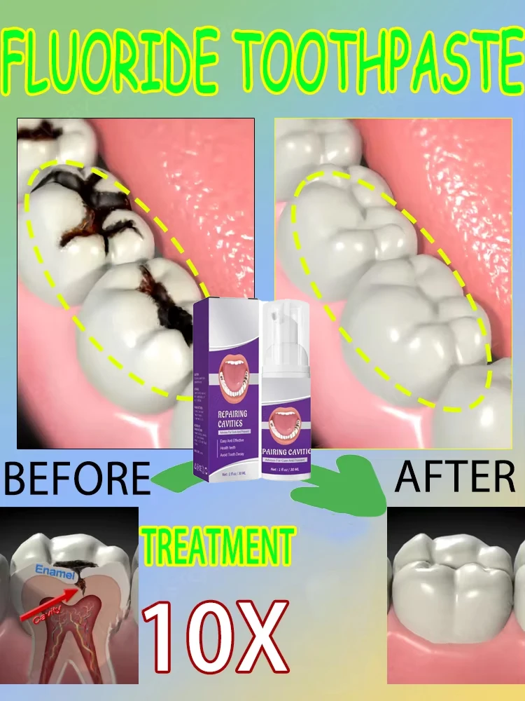 Ventas calientes Más vendido,  - Teeth Whitening That Works reseña y precio