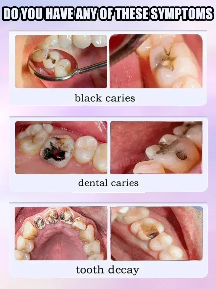 Ventas calientes Más vendido,  - Teeth Whitening That Works reseña y precio