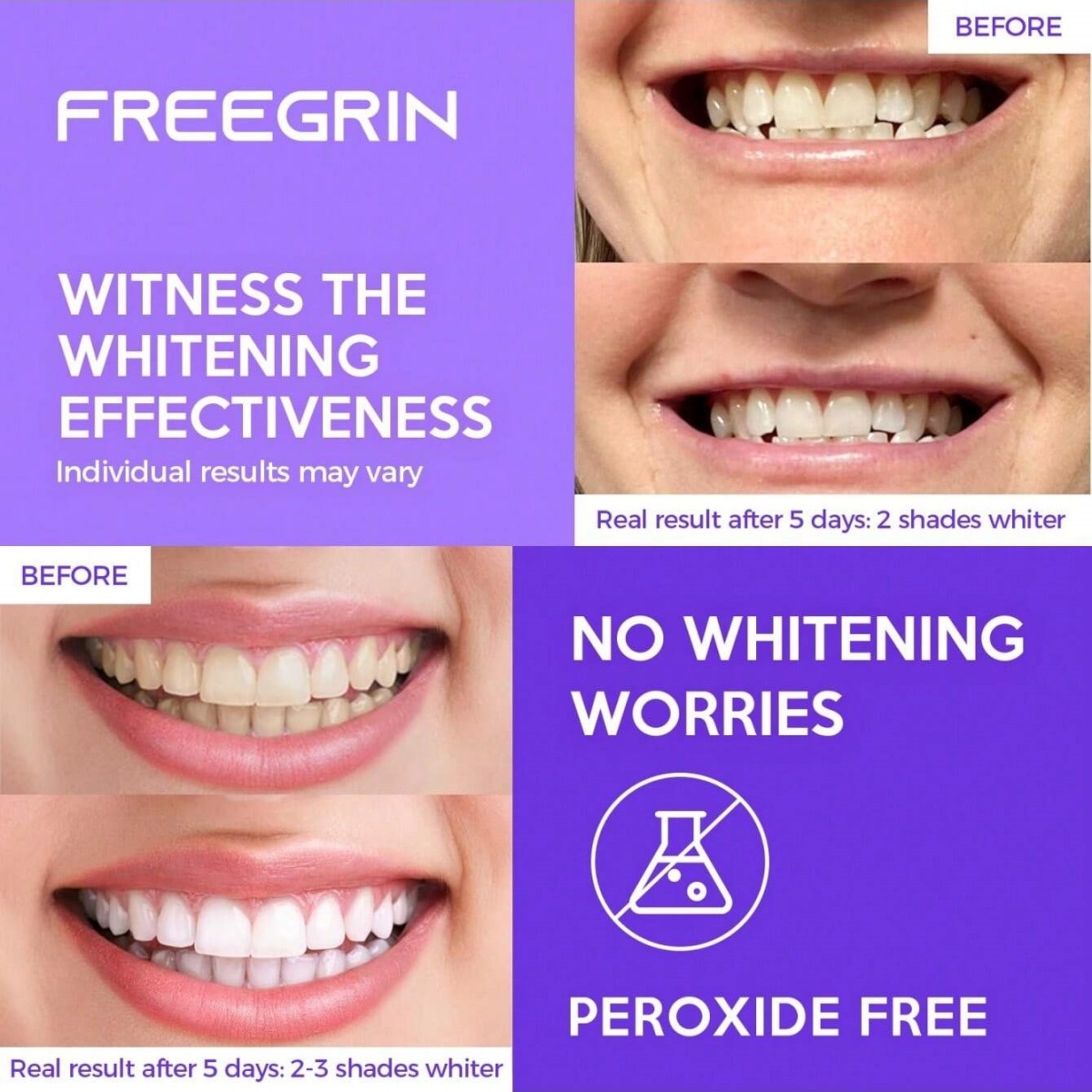 Pegatinas blanqueadoras de die - Teeth Whitening Gels reseña y precio